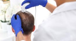 Queda de cabelo afeta a autoestima: tratamentos clínicos na tricologia são opção