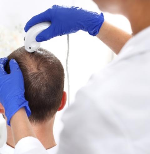 Queda de cabelo afeta a autoestima: tratamentos clínicos na tricologia são opção